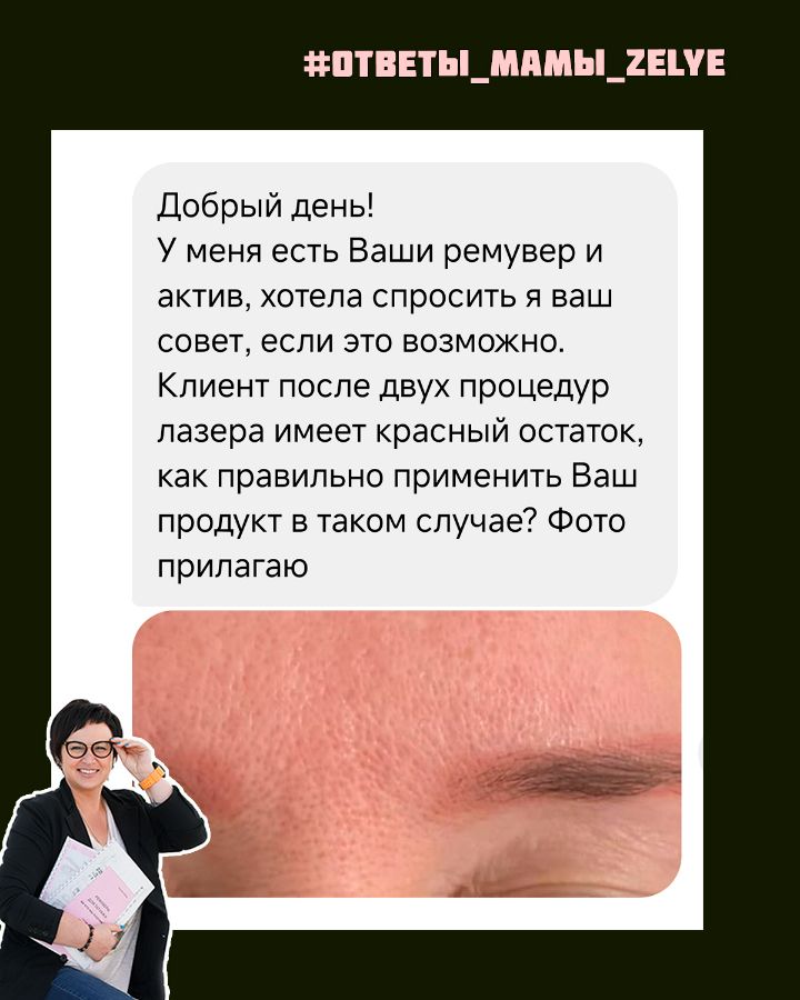 Как убрать красные брови после лазерного удаления татуажа