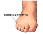 Консультация ортопеда (специализация - стопы, ноги, осанка)