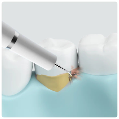 Ультразвуковой скалер Xiaomi Dr. Bei YC2 Ultrasonic Tooth Cleaner