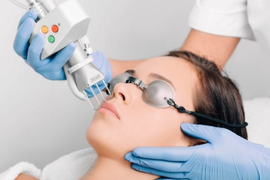 Лазерная шлифовка Deka