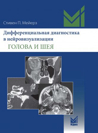 Дифференциальная диагностика в нейровизуализации. Голова и шея. Мейерз Стивен П. &quot;МЕДпресс-информ&quot;. 2023