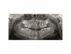 Gendex GXDP-300™ - Цифровая панорамная рентгенодиагностическая система | KAVO DENTAL (Германия)