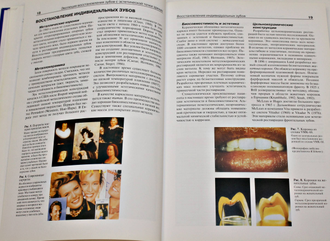 Шмидседер Дж. Эстетическая стоматология. Атлас по стоматологии. М.: МЕД-пресс-информ. 2004г.