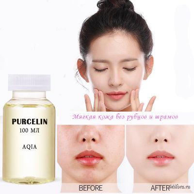 PURCELIN (POLYMOL PCL) ОТ РАСТЯЖЕК НА КОЖЕ