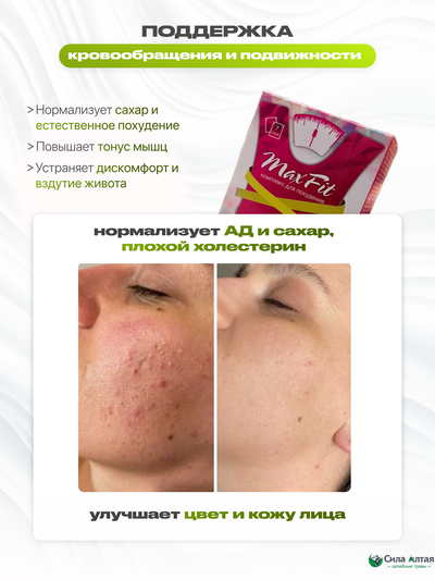 Максфит, комплекс для похудения