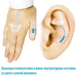 Дэнас ПКМ | Нейродэнс. Акупунктурные системы кисти, стопы и ушной раковины.