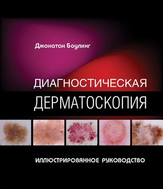 Диагностическая дерматоскопия. Джонатан Боулинг. &quot;Издательство Панфилова&quot;. 2018