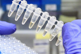 Анализы (часть 1)