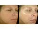 Увлажнитель для кожи лица. Аппарат косметологический для увлажнения кожи (нано) + зарядное устройство